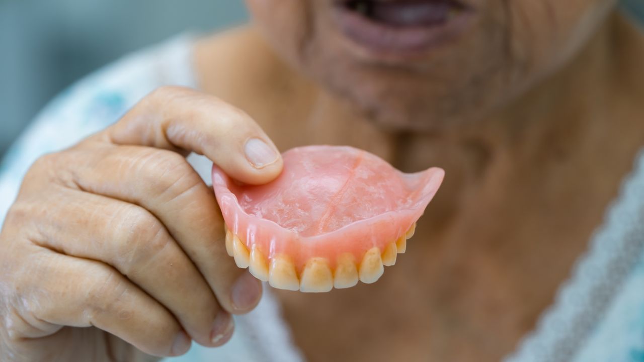 Caring for your partial