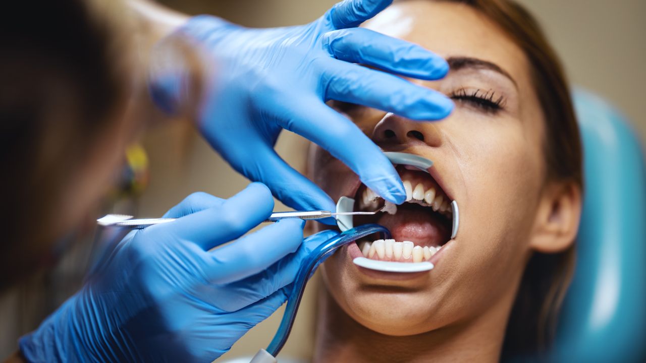 Common reasons for extraction