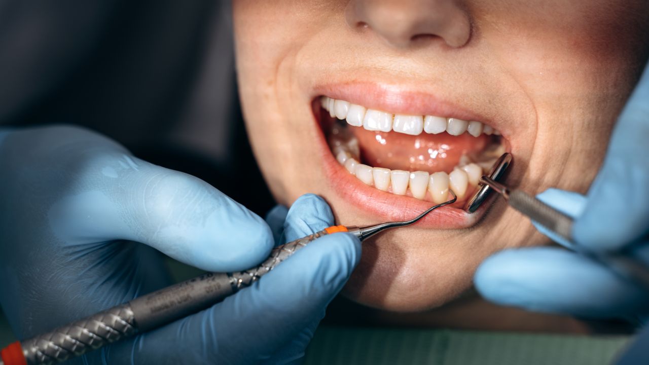 Common signs of a cracked tooth