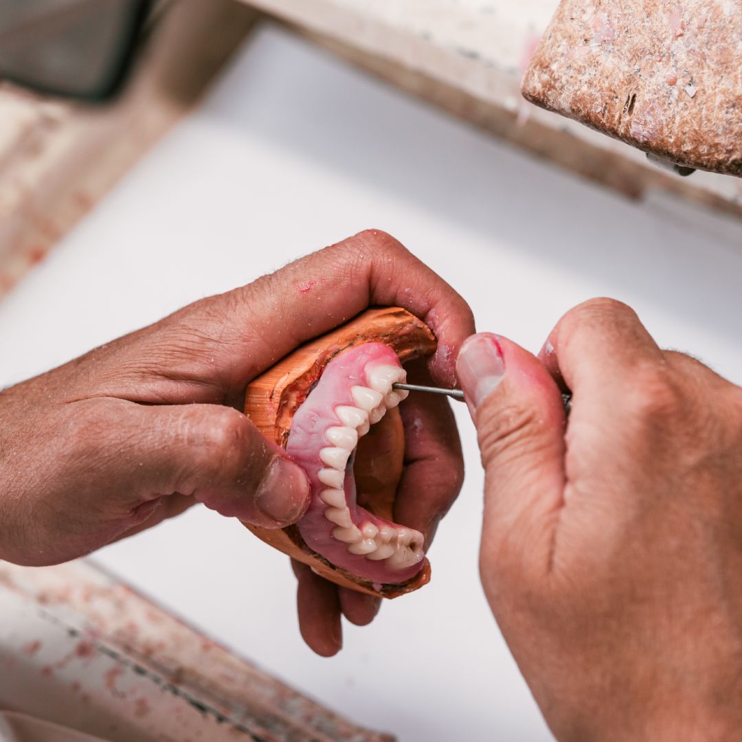 Denture Repairs