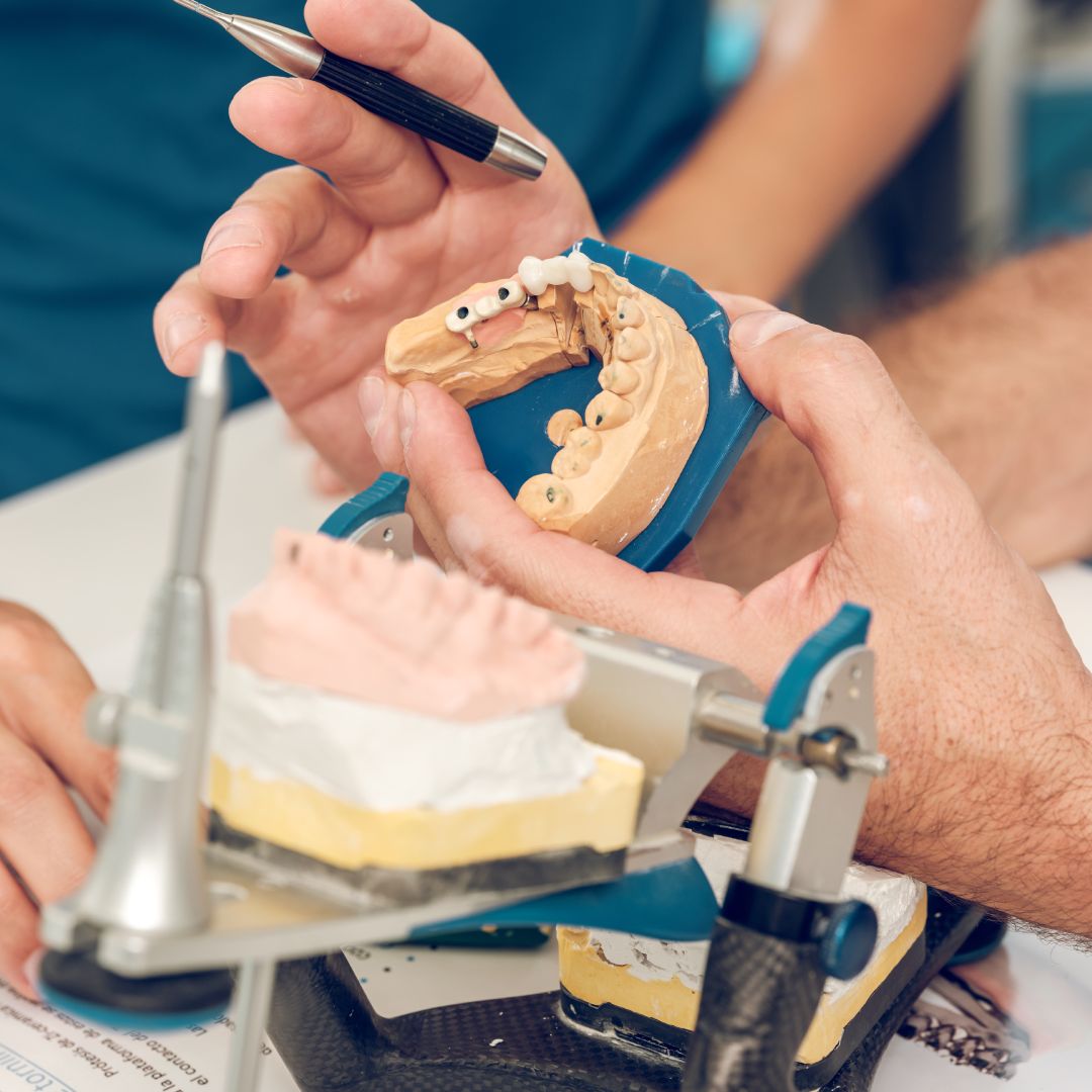 Denture repairs