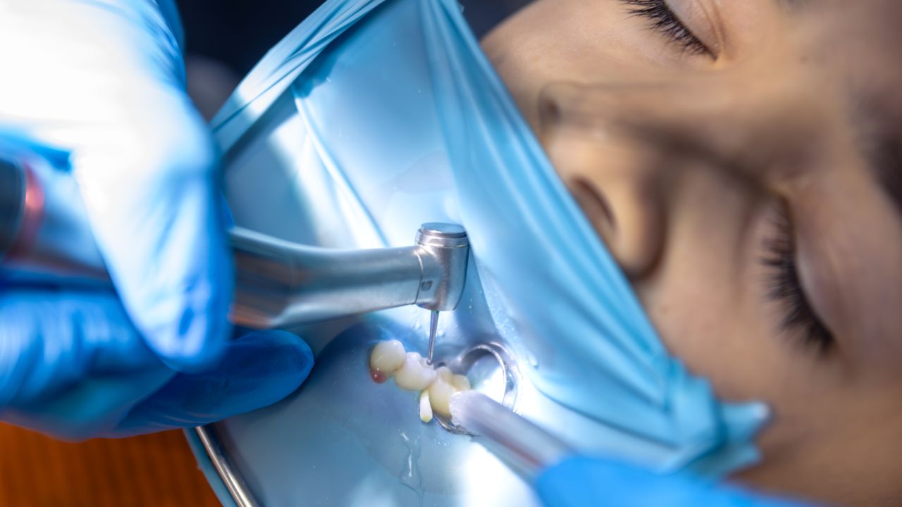 Healing and aftercare