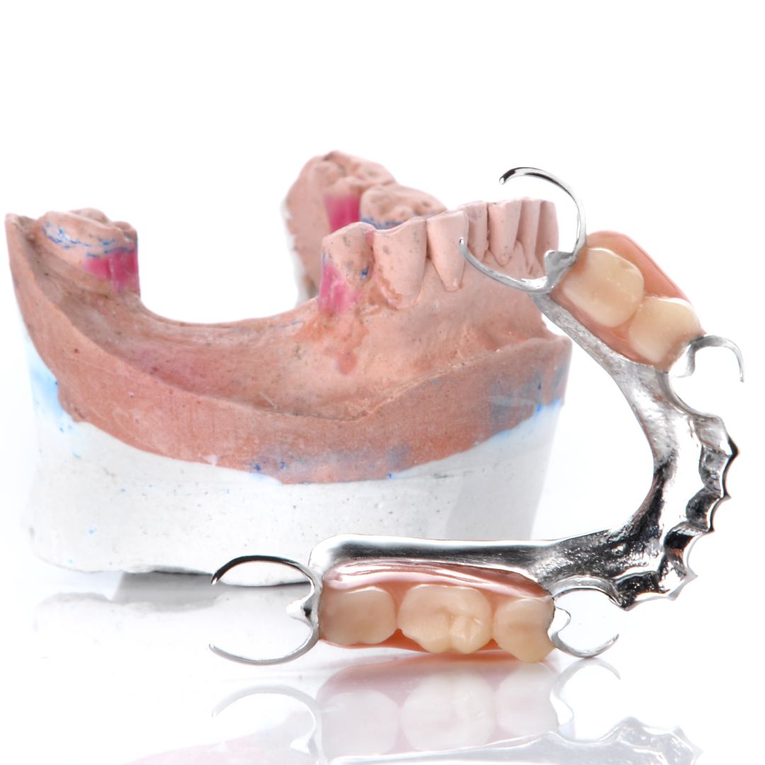 Partial Dentures