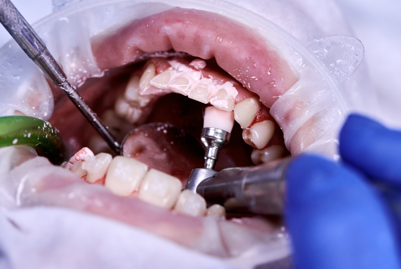 Restorative Dentistry