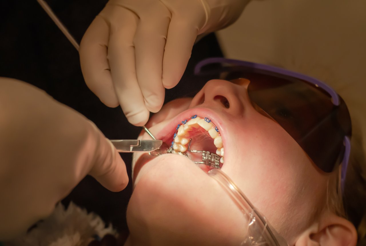 Restorative Dentistry