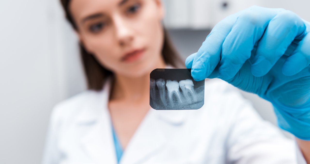 When we recommend X-rays