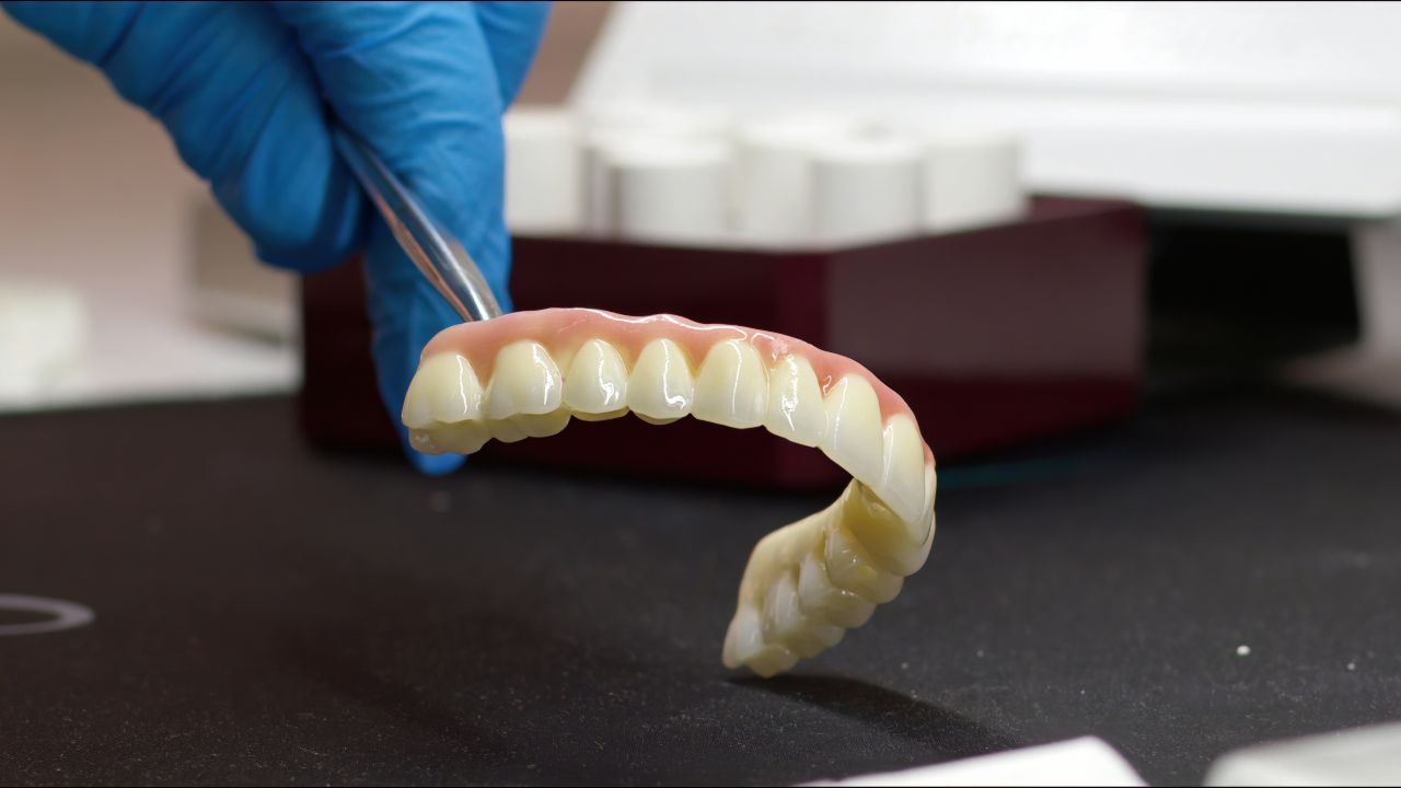 Why choose partial dentures