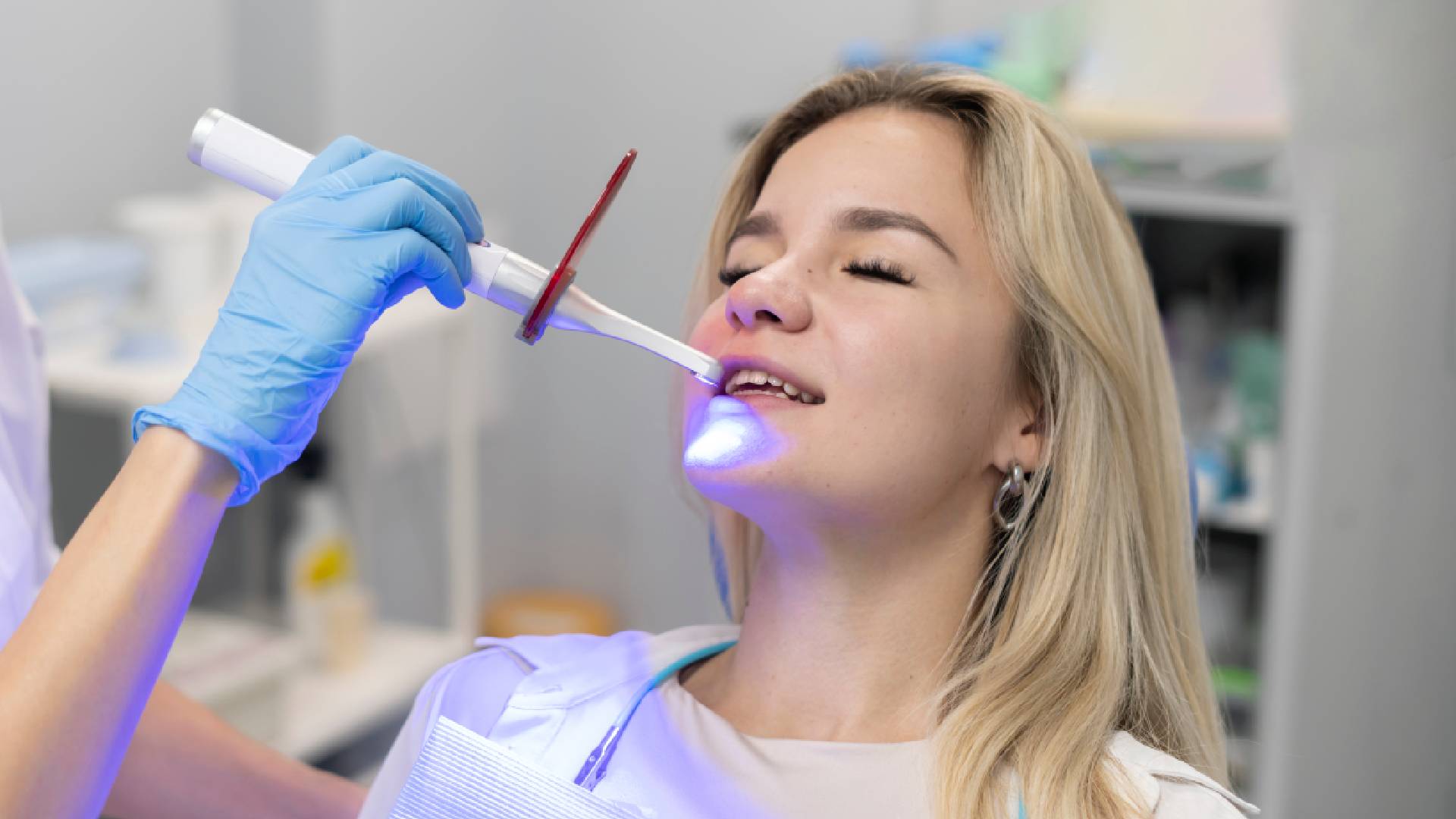 Transform Your Look with an Effective Dental Bonding Service